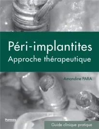 Péri-implantites. Approche thérapeutique